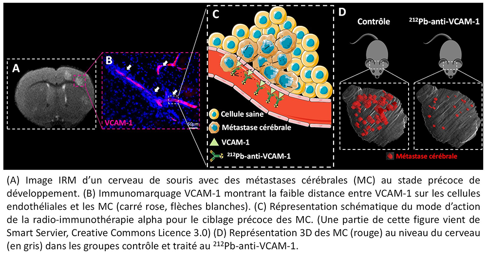 Un modèle murin de traitement des métastases cérébrales par radio ...