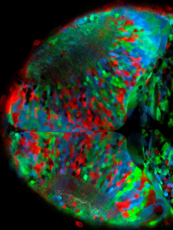 Thanks to its small size and optical transparency the brain of the zebrafish can be imaged as subcellular resolution in vivo.