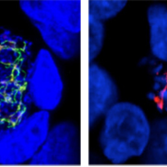 Malaria and toxoplasmosis have an Achilles heel from plants