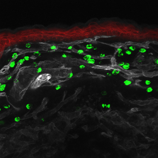 The search for the origin of mast cells