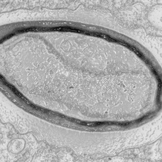 Pandoravirus : giant viruses invent their own genes