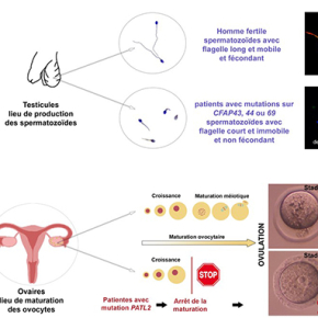 Les gènes impliqués dans l’infertilité masculine et féminine se dévoilent