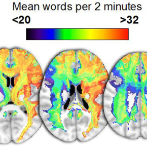 La face cachée des lésions cérébrales