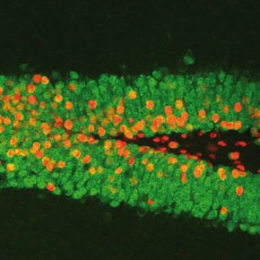 Quand les virus aident à mieux comprendre le fonctionnement du cerveau