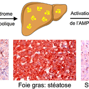 Une cible thérapeutique dans la surcharge lipidique du foie ?