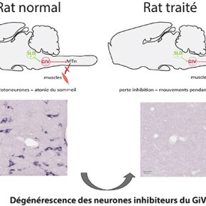 Comment le cerveau protège-t-il nos rêves pendant notre sommeil ?