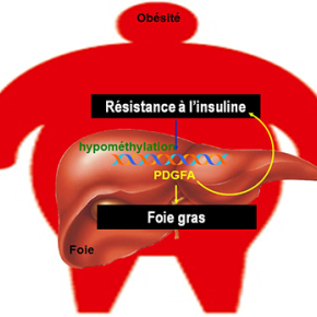 PDGFA, un facteur de croissance qui lie la maladie du soda et le diabète