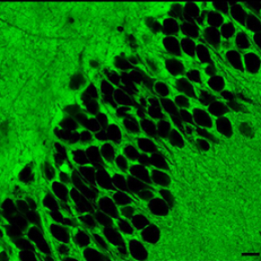 Sortir de l'ombre : les espaces extracellulaires du cerveau dévoilés