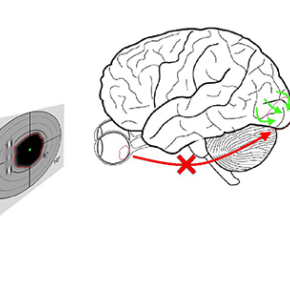 Apprendre au cerveau à s’adapter à la DMLA