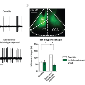 Le cortex cingulaire antérieur, entre douleur et dépression